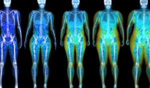 DEXA Scans768x452