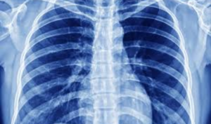 Digital X-Rays-768x452