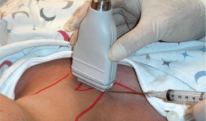 Image-Guided Procedures768x452